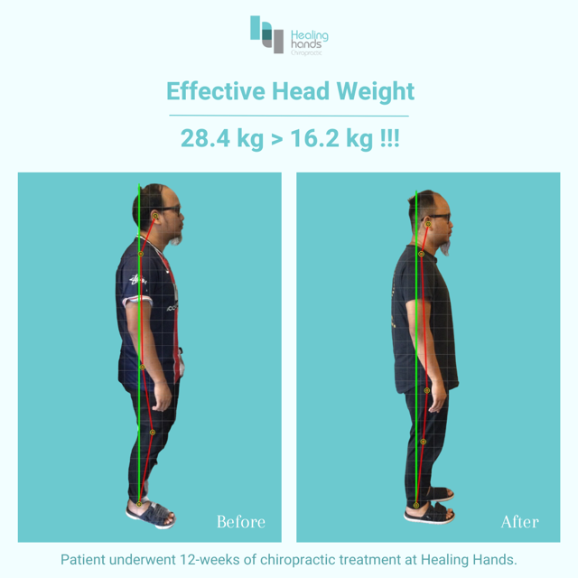 Chiropractic Before and After - Knee and Lower Back Pain