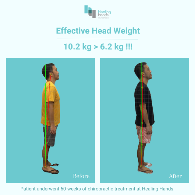 Chiropractic Before and After - Chronic Pains