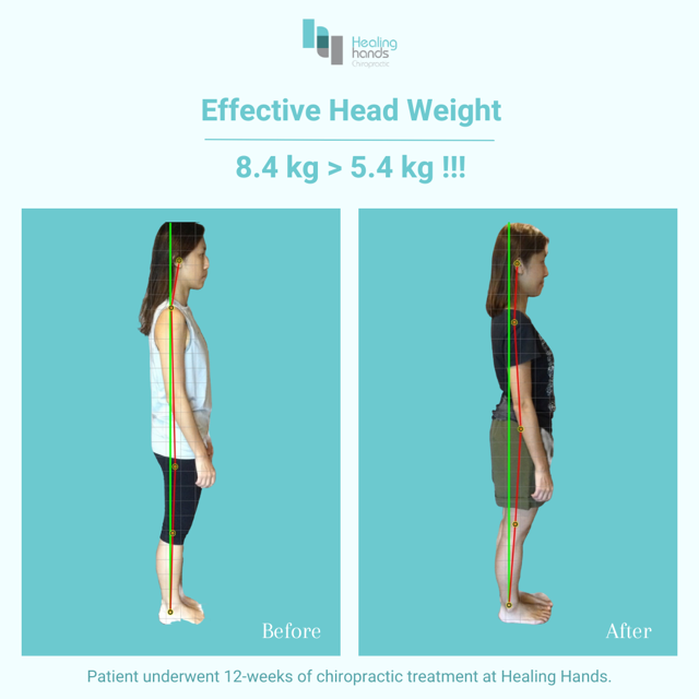 Chiropractic Before and After - Knee Back and Neck Pain